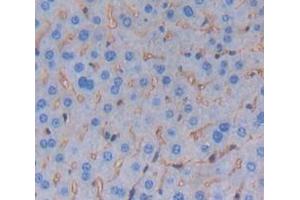 IHC-P analysis of Mouse Tissue, with DAB staining. (TREM1 Antikörper  (AA 21-230))