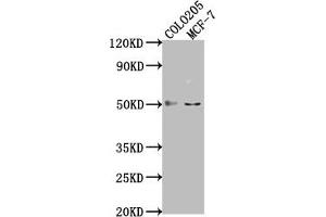Western Blot Positive WB detected in: COLO205 whole cell lysate, MCF-7 whole cell lysate All lanes: LRAT antibody at 1:2000 Secondary Goat polyclonal to rabbit IgG at 1/50000 dilution Predicted band size: 26 kDa Observed band size: 50 kDa