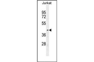 Western blot analysis of ETS1 Antibody (N-term) in Jurkat cell line lysates (35ug/lane).