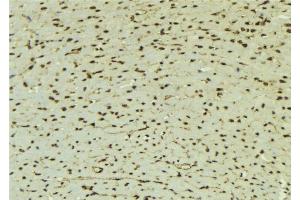ABIN6277622 at 1/100 staining Mouse muscle tissue by IHC-P. (TLE1 Antikörper  (Internal Region))