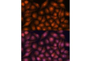 Immunofluorescence analysis of HeLa cells using DDX31 antibody (ABIN7266695) at dilution of 1:100. (DDX31 Antikörper  (AA 652-851))