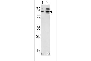 Western blot analysis of ACVR2A (arrow) using rabbit polyclonal ACVR2A Antibody (N-term) (ABIN391160 and ABIN2841268).