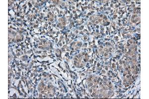 Immunohistochemical staining of paraffin-embedded Human Kidney tissue using anti-TBXAS1 mouse monoclonal antibody.