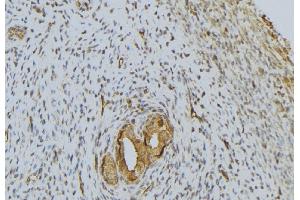 ABIN6276642 at 1/100 staining Human uterus tissue by IHC-P. (PRSS1 Antikörper  (Internal Region))