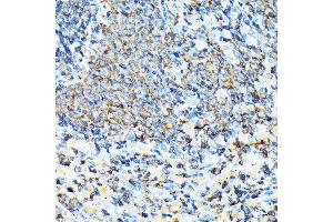 Immunohistochemistry of paraffin-embedded mouse spleen using CORO1A Rabbit pAb (ABIN6133495, ABIN6138903, ABIN6138904 and ABIN6224969) at dilution of 1:100 (40x lens). (Coronin 1a Antikörper  (AA 362-461))