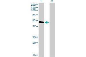 Western Blot analysis of TNFRSF19 expression in transfected 293T cell line by TNFRSF19 monoclonal antibody (M01), clone 2G4. (TNFRSF19 Antikörper  (AA 30-119))