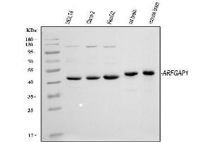 Western blot analysis of ARFGAP1 using anti-ARFGAP1 antibody (ABIN4886474).