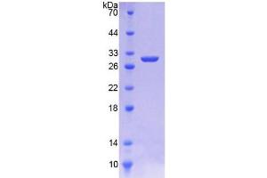 SDS-PAGE analysis of Rat HMGCR Protein. (HMGCR Protein)