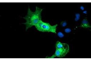 Anti-CALCOCO2 mouse monoclonal antibody (ABIN2453988) immunofluorescent staining of COS7 cells transiently transfected by pCMV6-ENTRY CALCOCO2 (RC203843). (CALCOCO2 Antikörper)