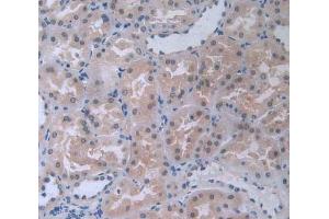 IHC-P analysis of kidney tissue, with DAB staining. (COL4a5 Antikörper  (AA 1461-1685))
