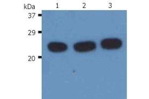 Western Blotting analysis (reducing conditions) of H-Ras in whole cell lysate using anti-H-Ras (H-RAS-03). (HRAS Antikörper)