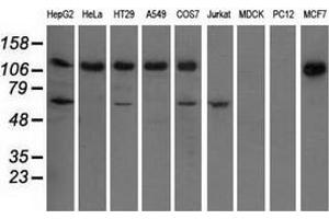 Western blot analysis of extracts (35 µg) from 9 different cell lines by using anti-IGF2BP2 monoclonal antibody. (IGF2BP2 Antikörper)