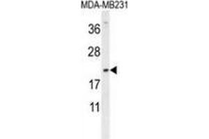 Western blot analysis in MDA-MB231 cell line lysates (35ug/lane) using DMRTC1 Antibody (N-term). (DMRTC1 Antikörper  (N-Term))