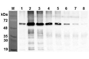 Immunoprecipitation of recombinant human FTO proteins using anti-FTO (human), mAb (AG103)  at different concentrations. (FTO Antikörper)