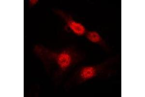 Immunofluorescent analysis of DGK alpha staining in MDCK cells. (DGKA Antikörper  (Center))