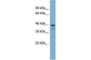 Host:  Rabbit  Target Name:  INPP5J  Sample Type:  Jurkat Whole Cell lysates  Antibody Dilution:  1. (INPP5J Antikörper  (C-Term))