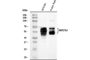 Western blot analysis of Tau/MAPT using anti-Tau/MAPT antibody (ABIN7599268).