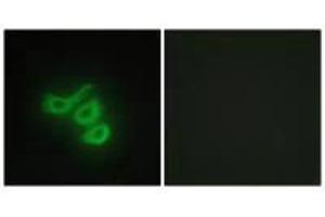 Immunofluorescence analysis of HepG2 cells, using M-CK antibody.