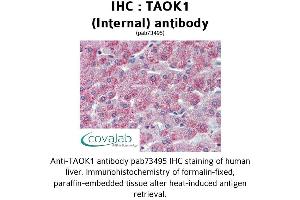 Image no. 2 for anti-TAO Kinase 1 (TAOK1) (Internal Region) antibody (ABIN1739900) (TAO Kinase 1 (TAOK1) (Internal Region) Antikörper)