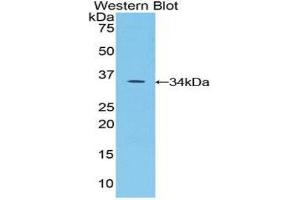 Western Blotting (WB) image for anti-serine Peptidase Inhibitor, Kazal Type 5 (SPINK5) (AA 734-995) antibody (ABIN1860612) (SPINK5 Antikörper  (AA 734-995))
