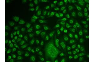 Immunofluorescence analysis of U2OS cell using TFPT antibody.