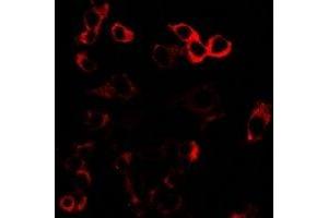 Immunofluorescent analysis of GLUR3 staining in U2OS cells. (Glutamate Receptor 3 Antikörper)