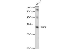 Western blot analysis of extracts of SKOV3 cells, using RSPO1 antibody (ABIN6132958, ABIN6147279, ABIN6147280 and ABIN6224304) at 1:1000 dilution. (RSPO1 Antikörper  (AA 21-263))