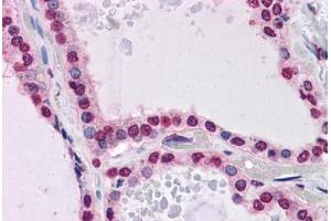 Human Thyroid: Formalin-Fixed, Paraffin-Embedded (FFPE) (KPNA7 Antikörper  (N-Term))