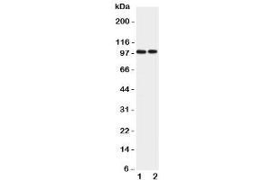 Western blot testing of EPB41L1 antibody and Lane 1:  rat brain (EPB41L1 Antikörper  (C-Term))