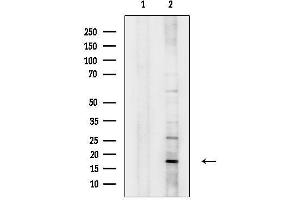 anti-Chromosome 2 Open Reading Frame 40 (C2orf40) (C-Term) antibody