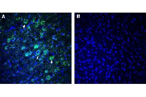 Expression of NEGR1 in rat parietal cortex Immunohistochemical staining of perfusion-fixed frozen rat brain sections with Anti-NEGR1 (extracellular) Antibody (ABIN7581917), (1:300), followed by goat anti-rabbit-AlexaFluor-488.
