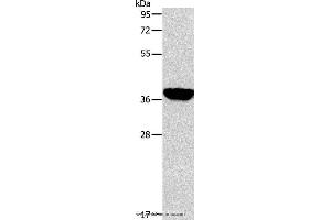 Western blot analysis of Mouse liver tissue, using ALDOB Polyclonal Antibody at dilution of 1:200 (ALDOB Antikörper)