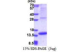 SDS-PAGE (SDS) image for Melanoma Inhibitory Activity (MIA) (AA 25-131) protein (His tag) (ABIN5853463)