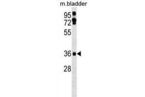 Western Blotting (WB) image for anti-Etoposide Induced 2.4 (EI24) antibody (ABIN3000878) (EI24 Antikörper)