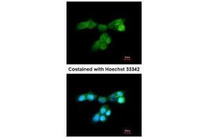 ICC/IF Image Immunofluorescence analysis of paraformaldehyde-fixed A431, using DUSP10, antibody at 1:200 dilution. (DUSP10 Antikörper  (C-Term))