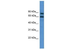 WB Suggested Anti-ZNF257 Antibody Titration:  0. (ZNF257 Antikörper  (C-Term))