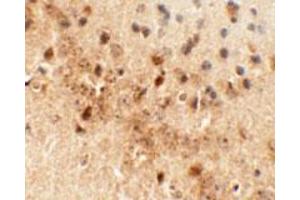Immunohistochemical analysis of DRAXIN in mouse brain tissue with DRAXIN polyclonal antibody  at 5 ug/mL. (DRAXIN Antikörper  (C-Term))