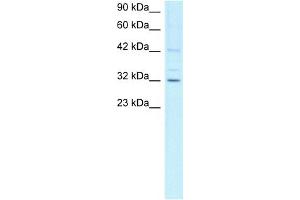 WB Suggested Anti-CCNH Antibody Titration:  1ug/ml  Positive Control:  Jurkat cell lysate CCNH is supported by BioGPS gene expression data to be expressed in Jurkat (Cyclin H Antikörper  (C-Term))