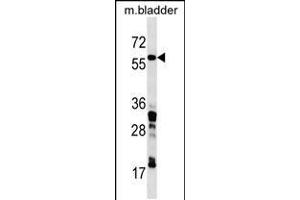 Western blot analysis in mouse bladder tissue lysates (35ug/lane). (CORO1C Antikörper  (C-Term))