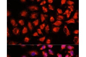 Immunofluorescence analysis of HeLa cells using ADAM8 Polyclonal Antibody at dilution of 1:100 (40x lens). (ADAM8 Antikörper)