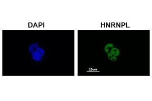 Immunofluorescent staining of MCF-7 cell with HNRNPL polyclonal antibody  at 1:200 dilution. (HNRNPL Antikörper  (AA 82-131))