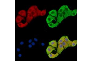 ABIN7096518 and ABIN7100582 staining Hela cells by IF/ICC. (OSBPL11 Antikörper)