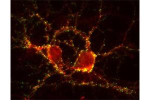 Immunocytochemistry (ICC) image for anti-SynCAM 1/2/3 (AA 436-446) antibody (ABIN1742491) (SynCAM 1/2/3 (AA 436-446) Antikörper)