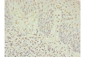 Immunohistochemistry of paraffin-embedded human tonsil tissue using ABIN7174944 at dilution of 1:100 (Myosin IC Antikörper  (AA 804-1063))