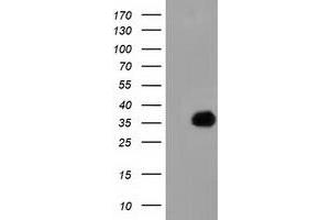 HEK293T cells were transfected with the pCMV6-ENTRY control (Left lane) or pCMV6-ENTRY FAM84B (Right lane) cDNA for 48 hrs and lysed. (FAM84B Antikörper)