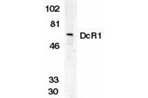 Western blot analysis of DcR1 in HeLa whole cell lysate with DcR1 antibody at 1 g/ml. (DcR1 Antikörper)