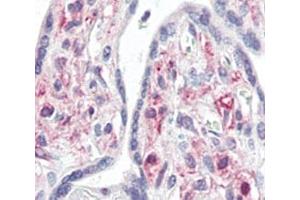 Immunohistochemistry (IHC) image for anti-Interleukin-1 Receptor-Associated Kinase 1 (IRAK1) (AA 683-712) antibody (ABIN3031490)