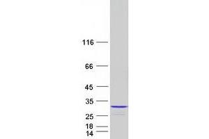 Validation with Western Blot (NUDT4 Protein (Transcript Variant 1) (Myc-DYKDDDDK Tag))