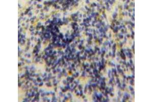 Used in DAB staining on fromalin fixed paraffin-embedded Spleen tissue (CCL24 Antikörper  (AA 27-119))