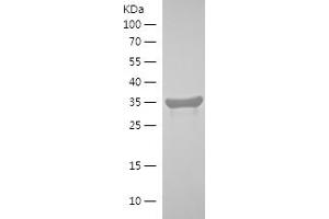 Western Blotting (WB) image for RAB1B, Member RAS Oncogene Family (RAB1B) (AA 59-199) protein (His-IF2DI Tag) (ABIN7124740) (RAB1B Protein (AA 59-199) (His-IF2DI Tag))